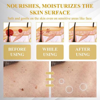 ATTDX® ClariBee Spot & Mole Corrective Cream