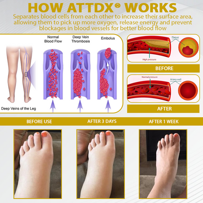 ATTDX® ApisChestnut Herbal Edema Relief Cream