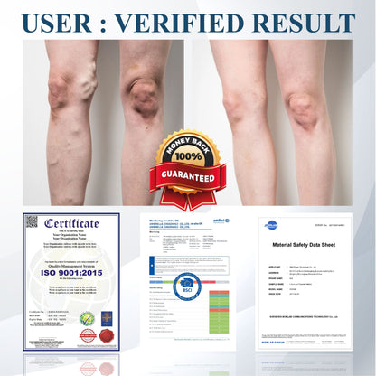 ATTDX® Black Cumin Edema Soothing Herbal Cream -👩‍⚕️Doctor-Endorsed Herbal Formula