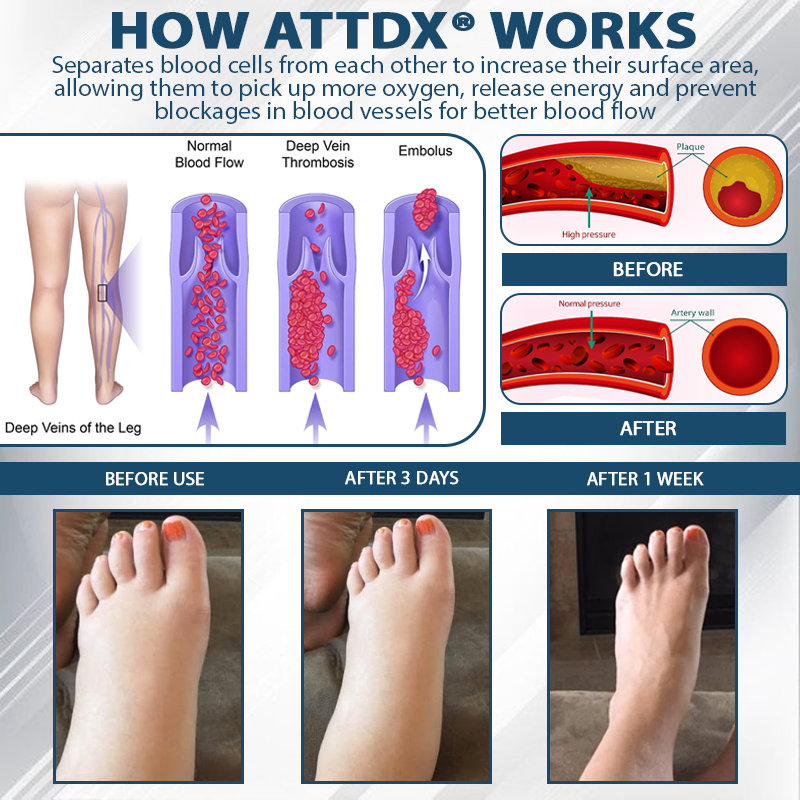 ATTDX® Black Cumin Edema Soothing Herbal Cream -👩‍⚕️Doctor-Endorsed Herbal Formula