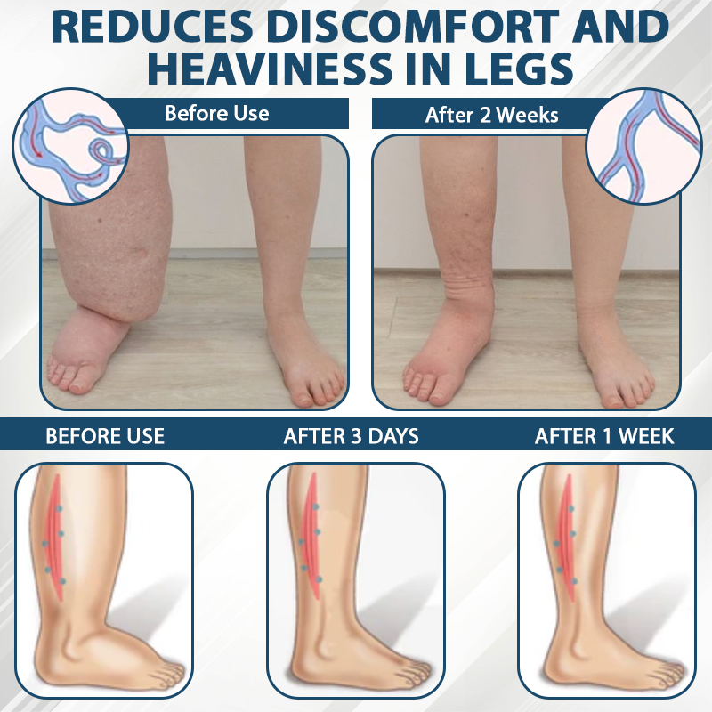 ATTDX® Black Cumin Edema Soothing Herbal Cream -👩‍⚕️Doctor-Endorsed Herbal Formula