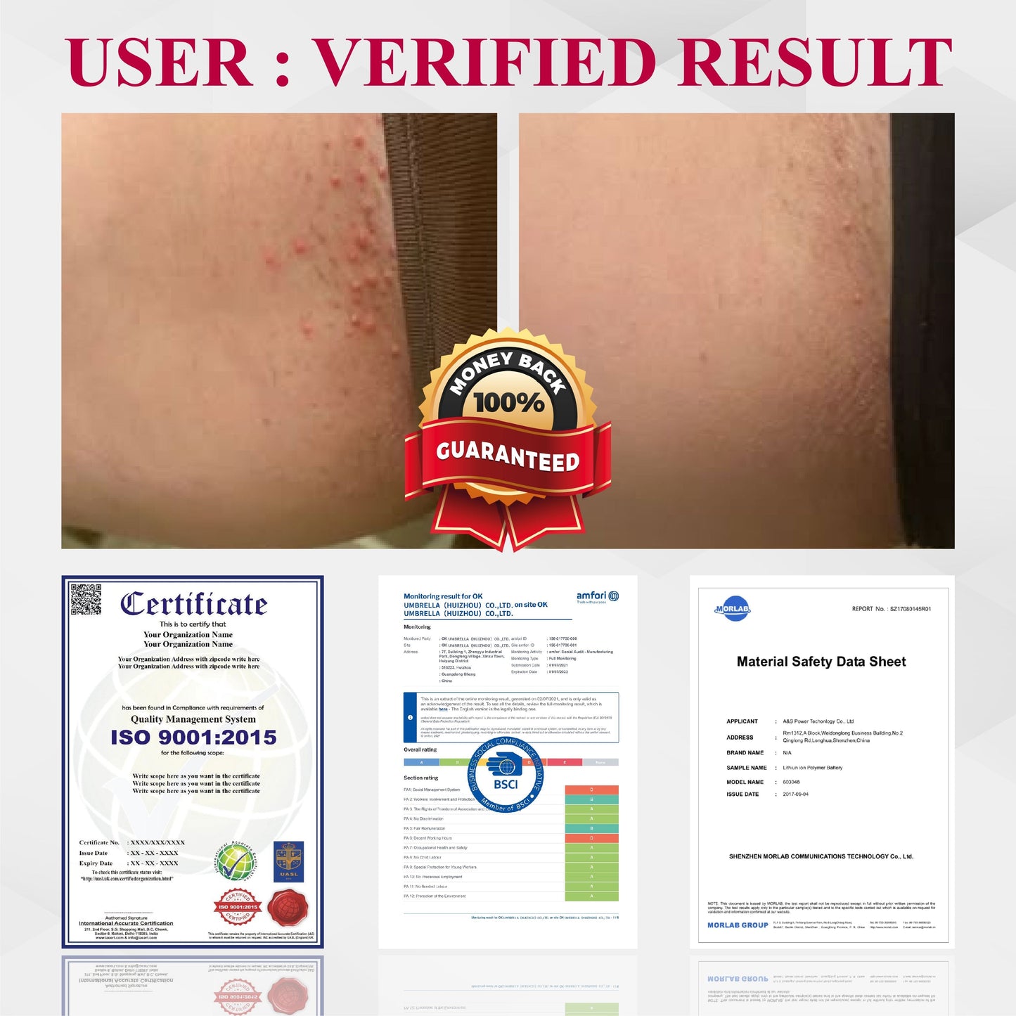 ATTDX® EndoBalance Woman's Genital HPV Healing Cream