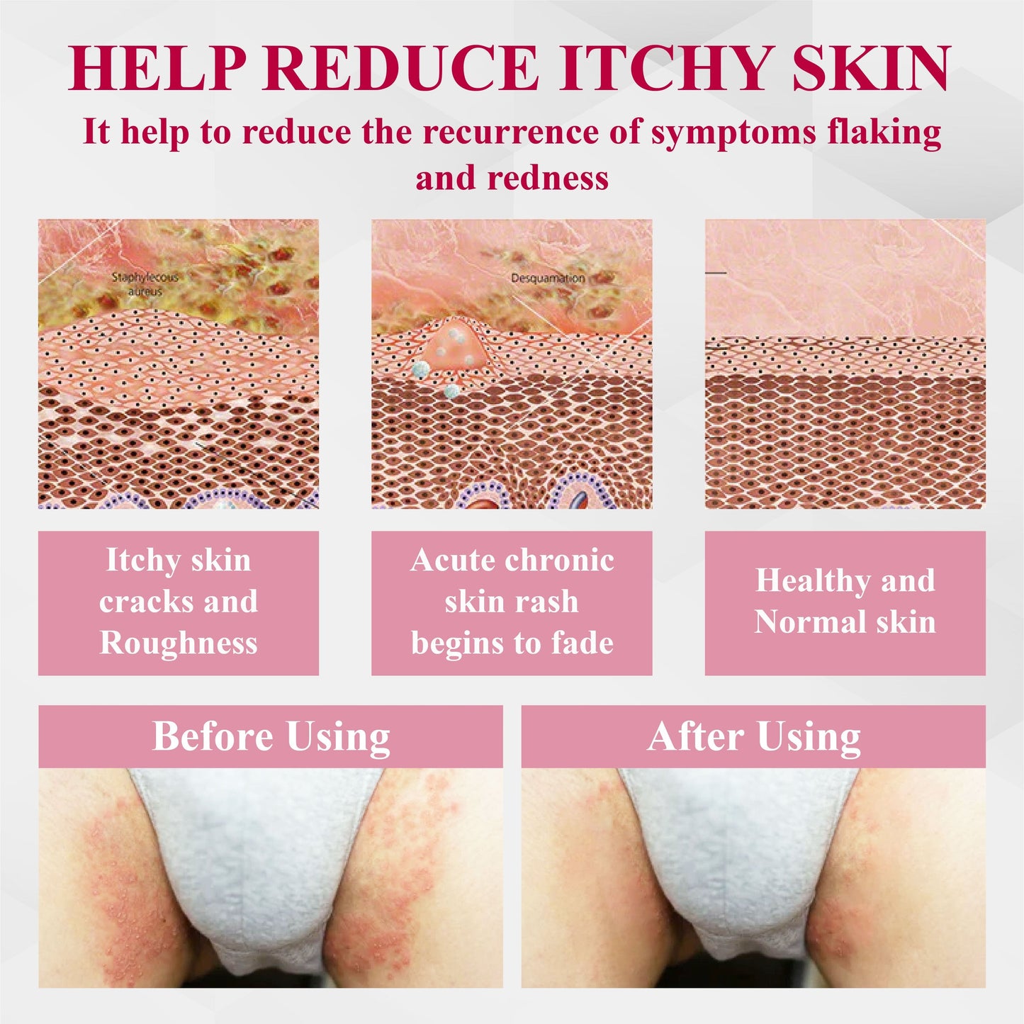 ATTDX® EndoBalance Woman's Genital HPV Healing Cream