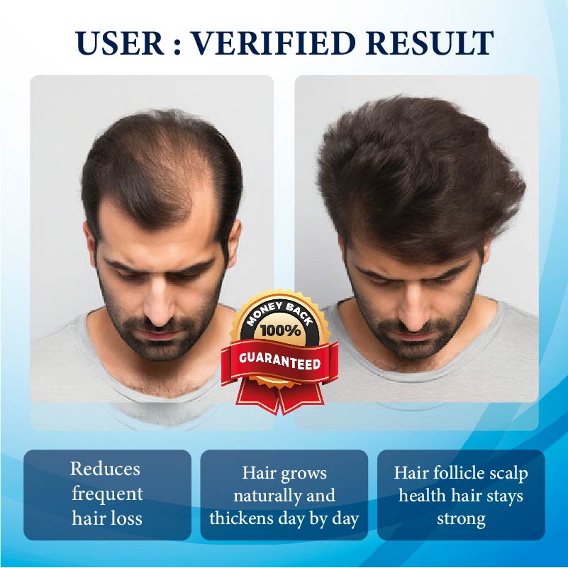 ThickBoost Herbal HairGrowth Serum for Men