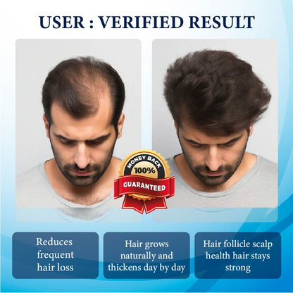 ThickBoost Herbal HairGrowth Serum for Men