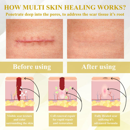 ApisClear™ Apis Venom Multi-Skin Healing Cream