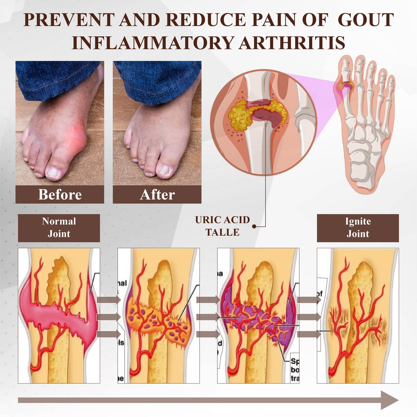 ATTDX® Emu Oil Turmeric Bone Sooth Gel 2