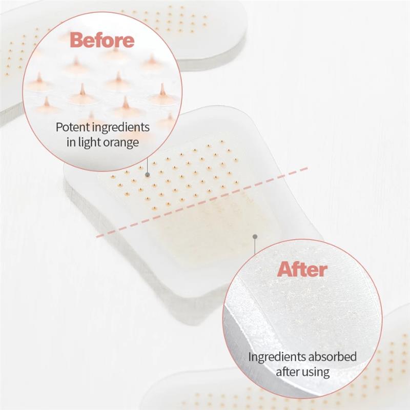 ATTDX® MicroSting Bee Vein Ease Patches