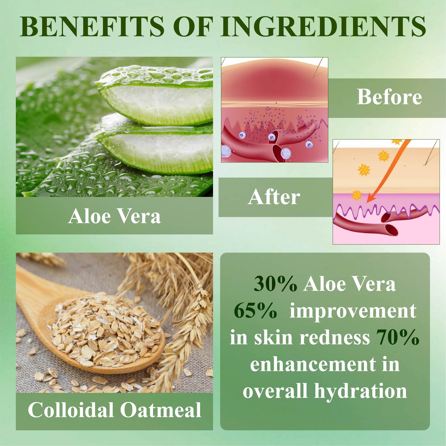 RelievaDerm™ Aloe SkinTherapy  HydratingGel