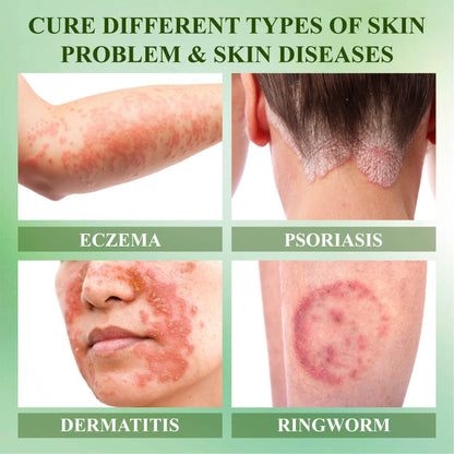 RelievaDerm™ Aloe SkinTherapy  HydratingGel