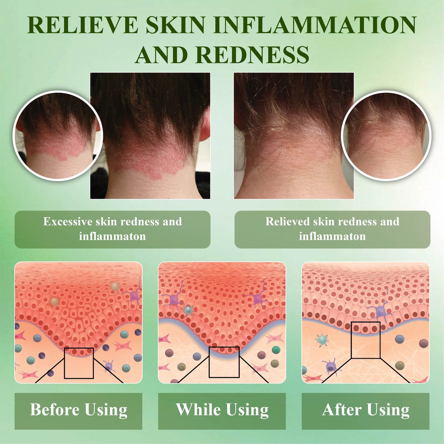 RelievaDerm™ Aloe SkinTherapy  HydratingGel