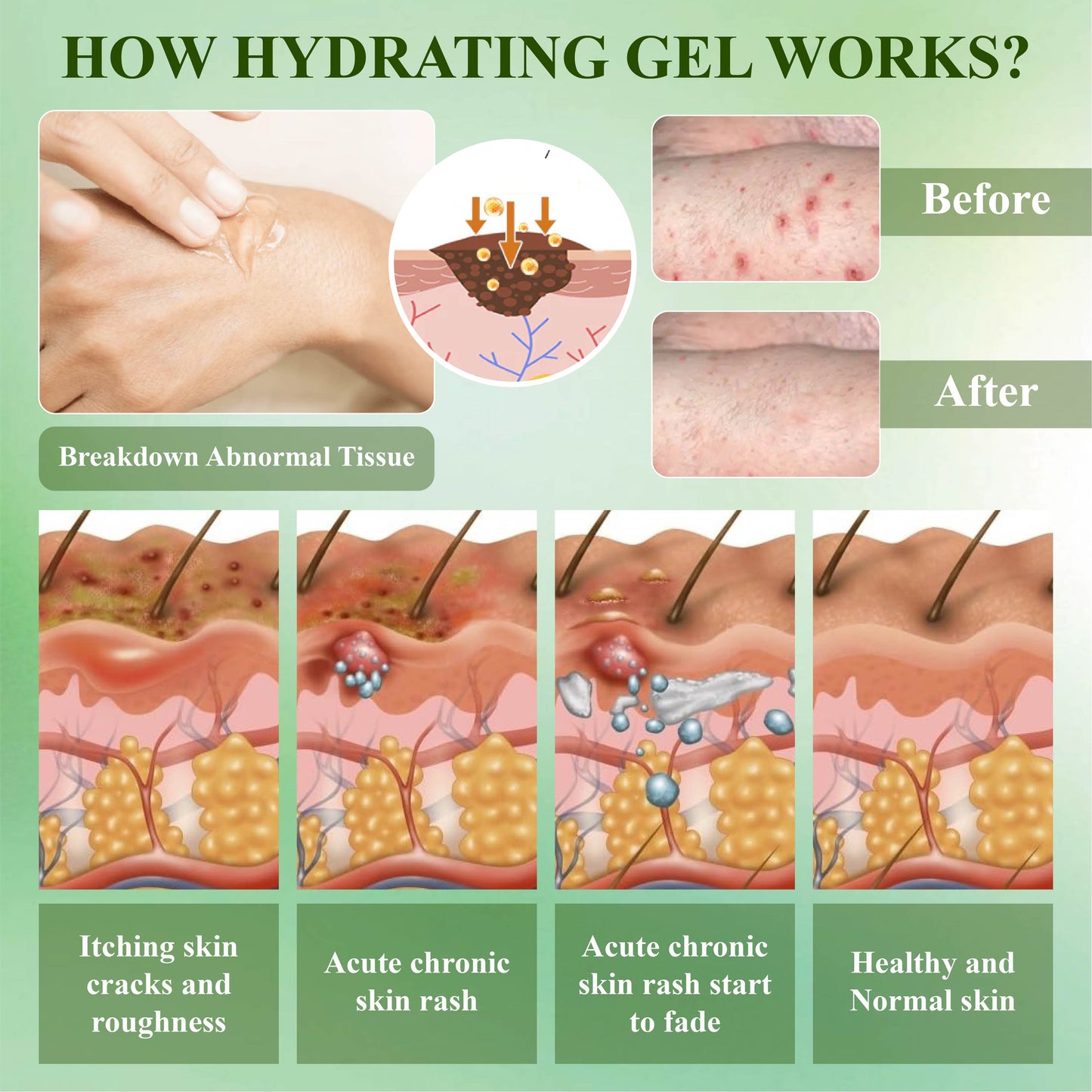 RelievaDerm™ Aloe SkinTherapy  HydratingGel