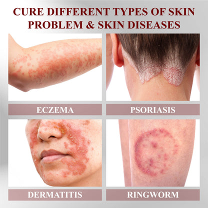 RelievaDerm™ Horse Chestnut Skin Therapy Gel